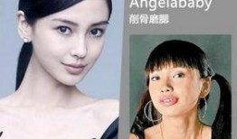 成都整容爆料案件最新,揭开医美行业潜规则与维权困境